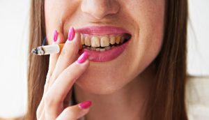 les conséquences de fumer sur la dentition
